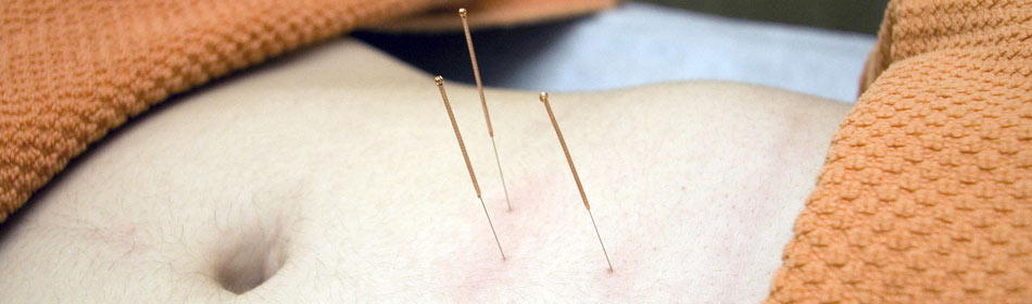 Accupuncture, Eastern Healing Arts in the Warrington, Bucks County PA area